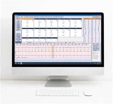 ระบบวิเคราะห์ ECG Holter แบบไดนามิก