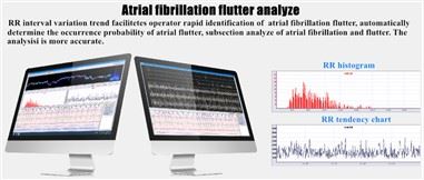 ระบบวิเคราะห์การตรวจสอบ Holter